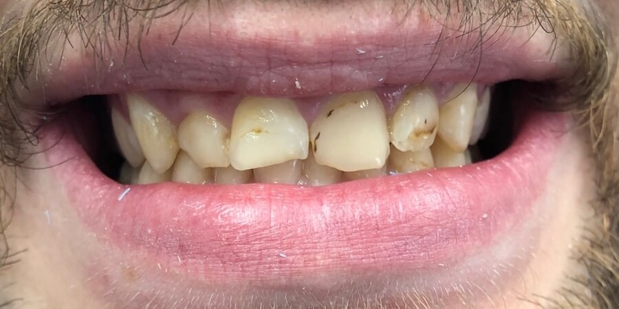 John Before