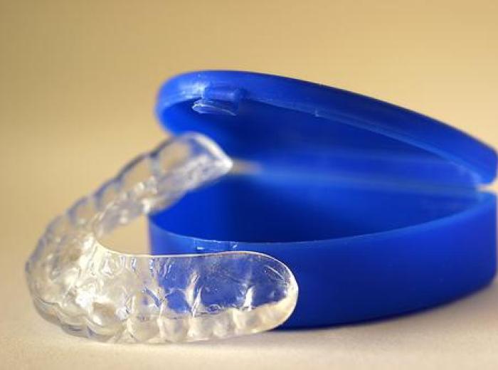Mouthguard Q&A